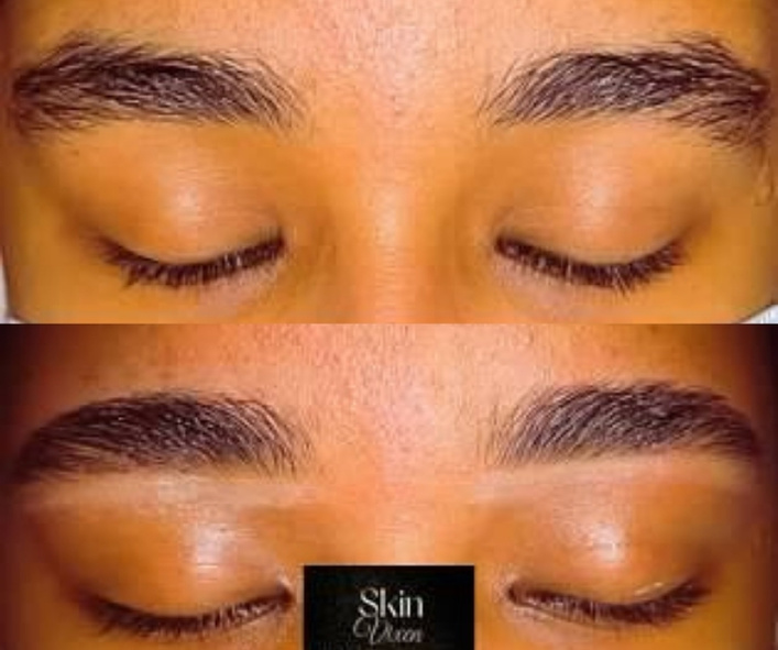 Brow and lash treatment before and after photos