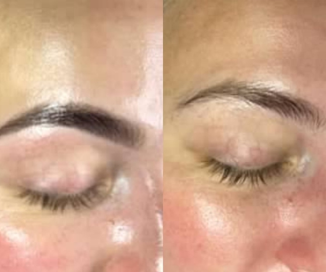 Brow and lash treatment before and after photos