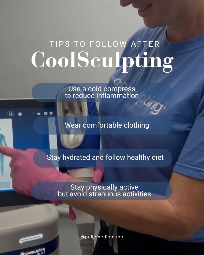 CoolSculpting tips